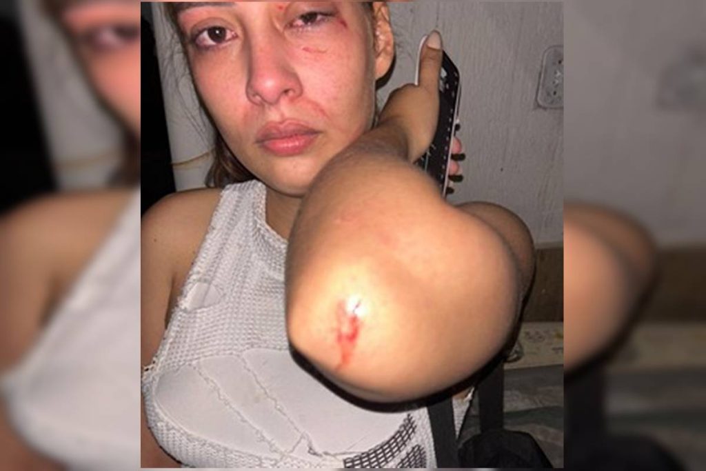 mulher-acorda-com-homem-de-cueca-em-cima-dela-apos-invasao-no-df;-veja