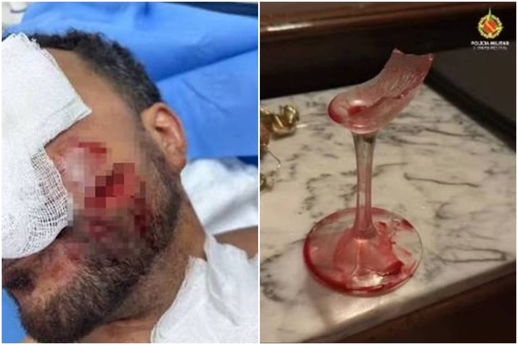 veja-como-ficou-o-rosto-de-funcionario-agredido-com-taca-por-advogado