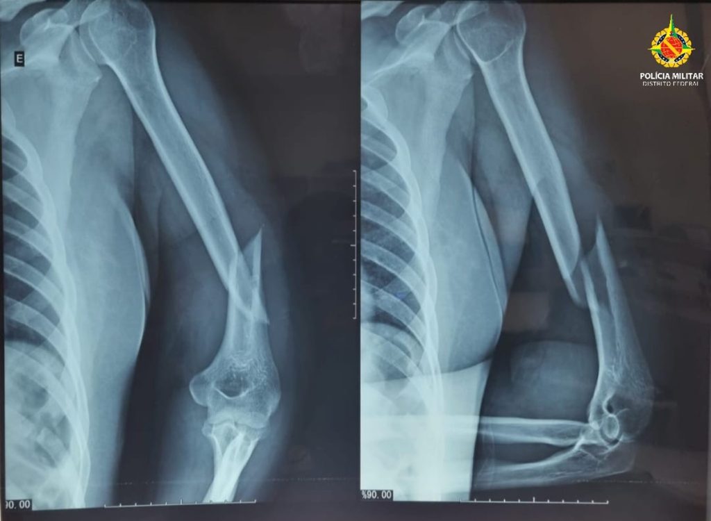 carroceiro-e-preso-apos-espancar-e-torturar-mulher-durante-6-horas-no-df