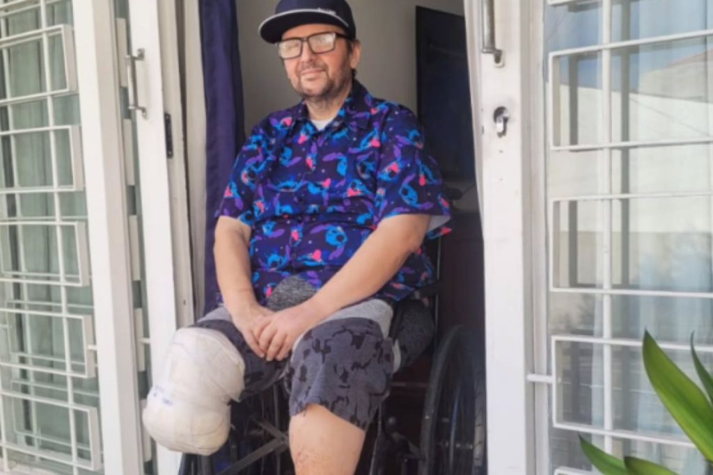 por-que-david-castilho,-de-a-praca-e-nossa,-teve-de-amputar-a-perna?