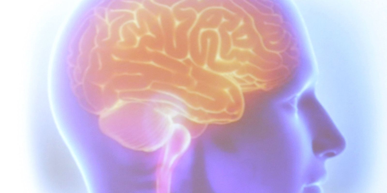 avc-mata-uma-pessoa-a-cada-seis-minutos-no-brasil avc-mata-uma-pessoa-a-cada-seis-minutos-no-brasil