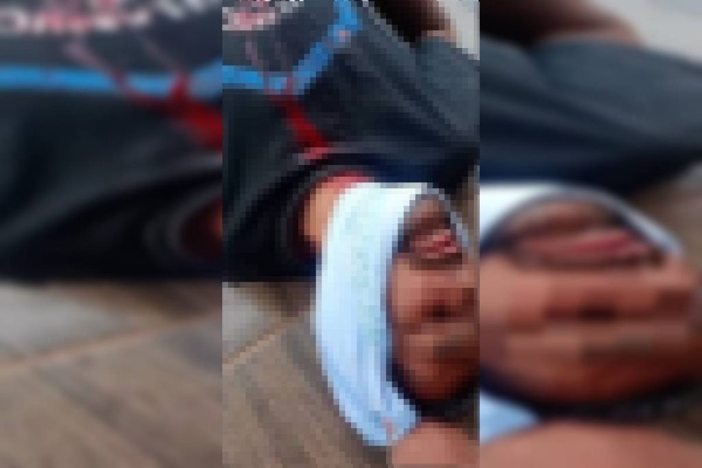 bebedeira-e-facada-na-jugular:-homem-acusa-amigo-de-furto-e-o-ataca