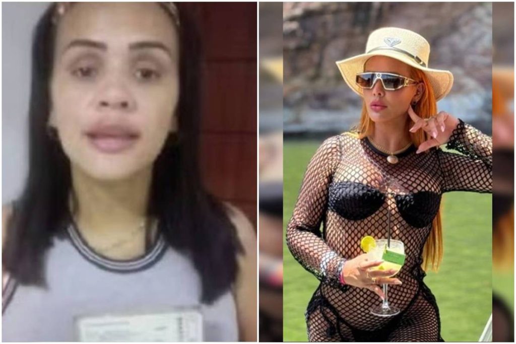 mulher-usa-grana-de-golpe-em-cirurgias-e-“antes-e-depois”-choca.-veja